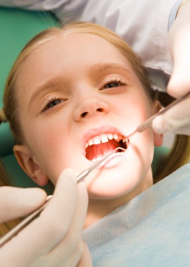 Dental Extraction