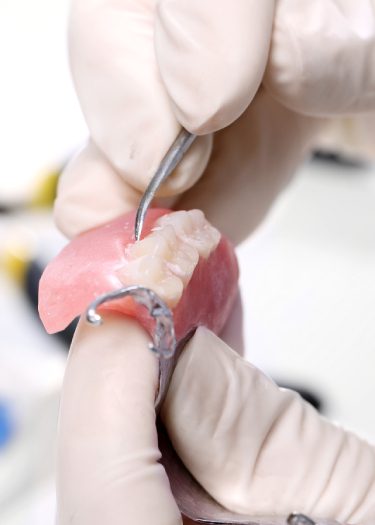 Prosthodontics-cleaning the dentures